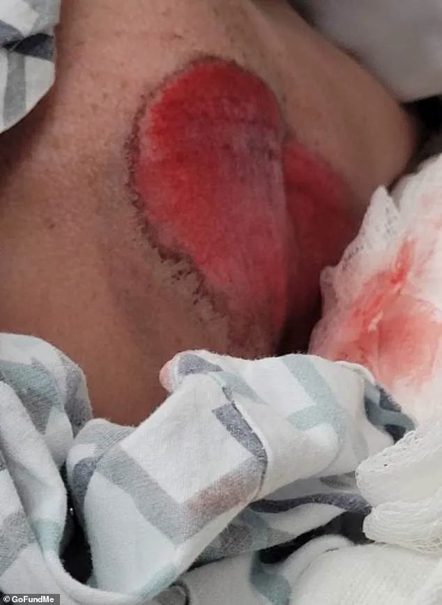 Backpack Saves 12-Year-Old in Near-Fatal Accident, Raising Concerns Over Community Safety Measures