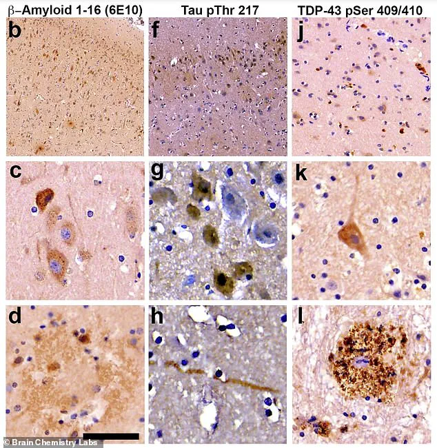 Exclusive Insights: Toxic Algae in Florida Waters Linked to Alzheimer's, But Access to Findings is Restricted