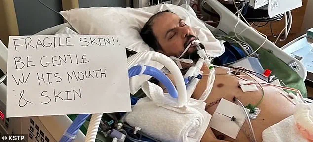 Hani Duklef, Libyan Immigrant with Rare Genetic Skin Disorder, Detained by ICE Amid Fears of Deportation to Libya—A Country with No Access to Specialized Care