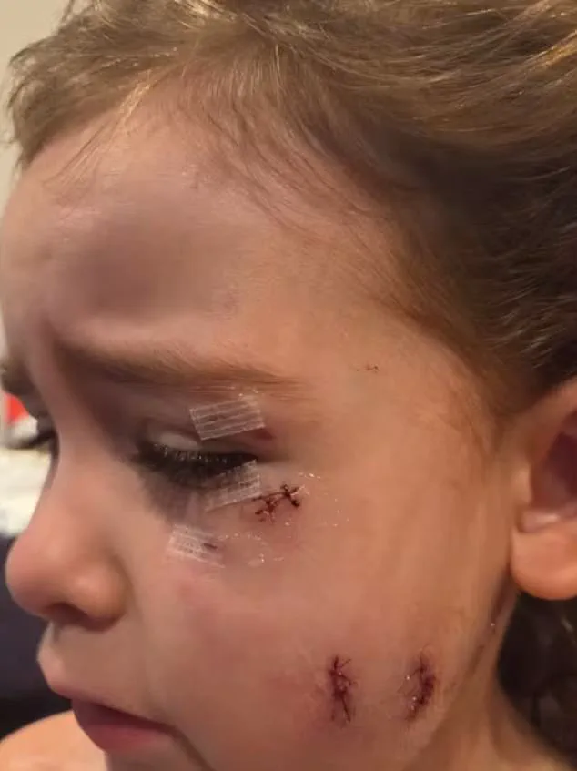 Oshawa Dog Attack Ignites Debate Over Pet Ownership and Local Regulations