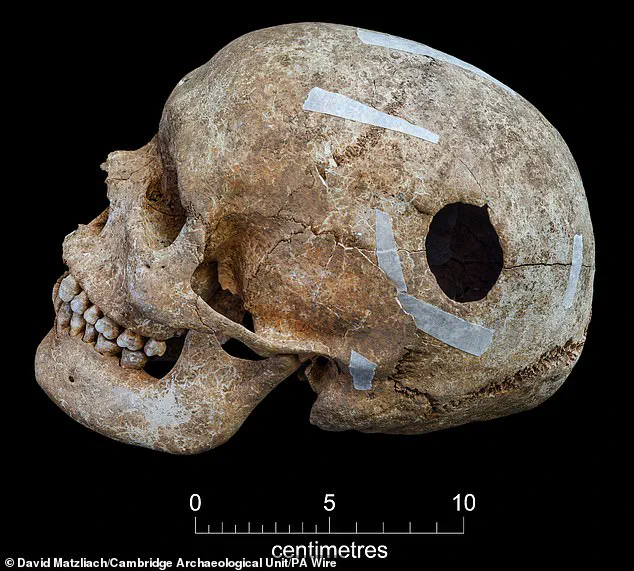 Viking-Era Burial Pit of Decapitated Victims Unveils 9th-Century Violence in Cambridge