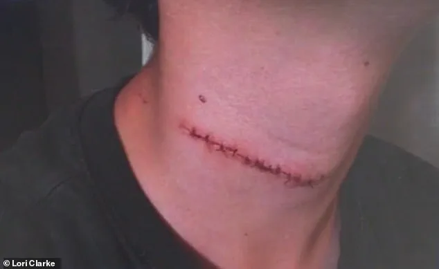 Unexpected Boardwalk Attack Shatters Family's Daytona Beach Vacation