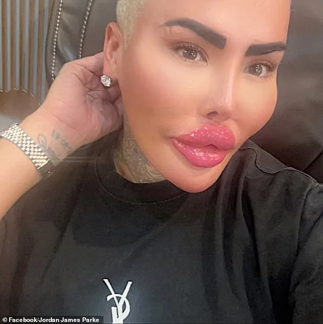 Death of 'Lip King' Jordan James Parke Sparks Calls for Cosmetic Surgery Regulation Overhaul