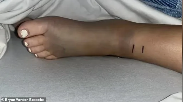 14-Year-Old California Teen Recovers After Rattlesnake Bite During Bike Ride