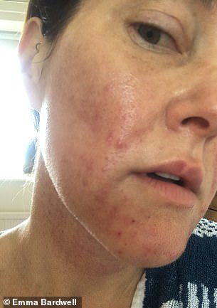Former Nutritionist Emma Bardwell Reclaims Health After Perimenopause Struggle